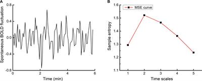 Effects of Multi-Session Repetitive Transcranial Magnetic Stimulation on Motor Control and Spontaneous Brain Activity in Multiple System Atrophy: A Pilot Study